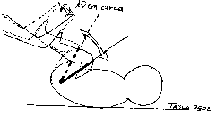 Ginnastica del neonato, fig. 1