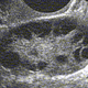 PCOSImage.gif