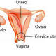 cervice_uterina.jpg